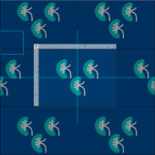 Tissu Nephrologie de Kidneys (Carreau)
