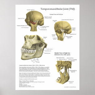 TMJ Joint Syndrome Anatomy Medical Poster