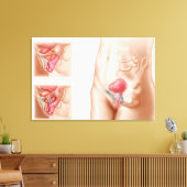 Toile Anatomie De La Procédure De Suspension De Vessie (Insitu(Salon))