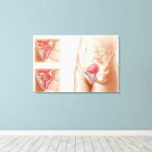 Toile Anatomie De La Procédure De Suspension De Vessie (Insitu (Plancher de Bois))