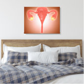 Toile Anatomie De L'Utérus Féminin Avec Ovaires (Insitu(Chambre))