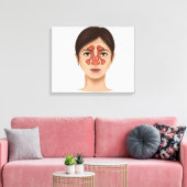 Toile Anatomie Des Sinus Nasaux (Insitu(Salon))