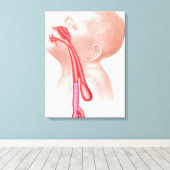 Toile Anatomie D'Une Fistule Trachéesophagienne (Insitu (Plancher de Bois))