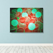 Toile Anémie De Cellule De Faucille Avec Cellules De San (Insitu (Plancher de Bois))