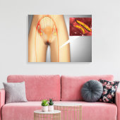 Toile Artère étroite près de la jambe Gros plan (Insitu(Salon))