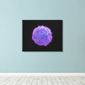 Toile Cellule de cancer de la peau humaine (Insitu (Plancher de Bois))