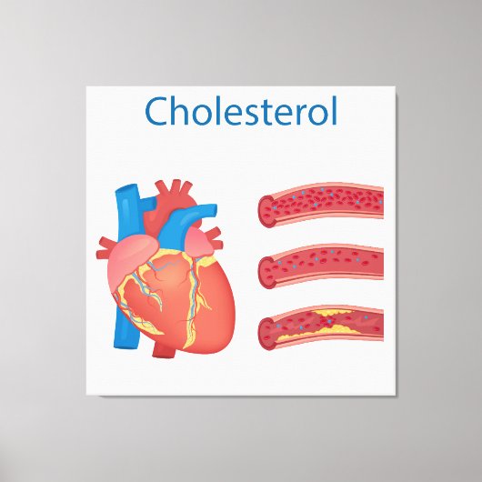 Toile Cholestérol (Recto)