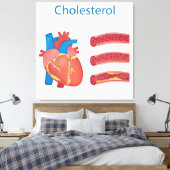 Toile Cholestérol (Insitu(Chambre))