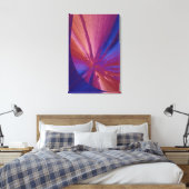 Toile Cristaux de cholestérol (Insitu(Chambre))