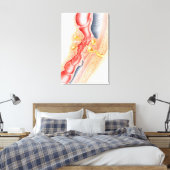 Toile Développement De La Fistule (Insitu(Chambre))