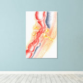 Toile Développement De La Fistule (Insitu (Plancher de Bois))