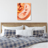 Toile Développement Du Foetus À 36 Semaines (Insitu(Chambre))