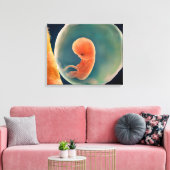 Toile Développement Du Foetus À 9 Semaines (Insitu(Salon))