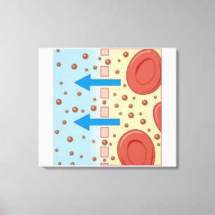 Toile Dialyse de rein