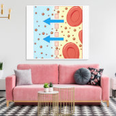 Toile Dialyse rénale (Insitu(Salon))