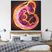 Toile Embryo (Insitu(Chambre))