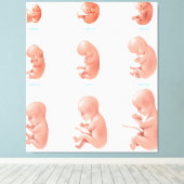 Toile Foetus humain (Insitu (Plancher de Bois))