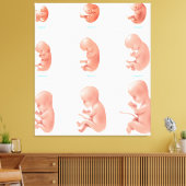 Toile Foetus humain (Insitu(Salon))