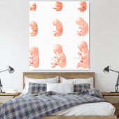Toile Foetus humain (Insitu(Chambre))