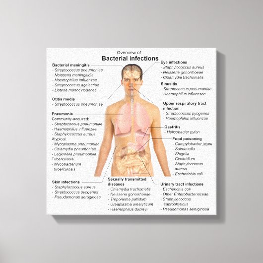 Toile Graphique des infections bactériennes chez l'homme (Recto)