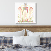 Toile Illustration de la carie dentaire (Insitu(Chambre))