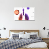 Toile Illustration d'une crise d'asthme causée par le po (Insitu(Chambre))