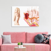 Toile Illustration D'Une Croissance Atypique Sur La Peau (Insitu(Salon))
