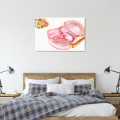 Toile Illustration Médicale D'EndOlymph (Insitu(Chambre))