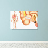 Toile Illustration Médicale D'Un Appendice (Insitu (Plancher de Bois))