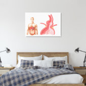 Toile Illustration Médicale D'Une Hernie Hiatal Dans (Insitu(Chambre))