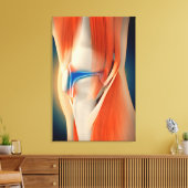 Toile Illustration Médicale : Inflammation Dans Le Genou (Insitu(Salon))