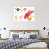 Toile Illustration montrant la cholécystectomie (Insitu(Chambre))