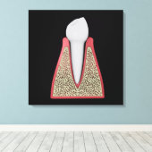 Toile Image Conceptuelle De La Dent Humaine 1 (Insitu (Plancher de Bois))