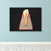 Toile Image Conceptuelle De La Dent Humaine 2 (Insitu (Plancher de Bois))