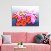 Toile Image Conceptuelle De L'Anémie Des Cellules De Fau (Insitu(Salon))