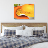 Toile Image Conceptuelle Des Pancréas Humains Et De L'Es (Insitu(Chambre))