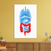 Toile Image En Rayon X D'Organes Internes Avec Gros (Insitu(Salon))