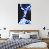 Toile Image par rayons X des os du cou (Insitu(Chambre))