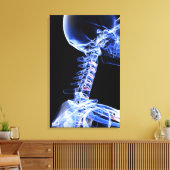 Toile Image par rayons X des os du cou (Insitu(Salon))