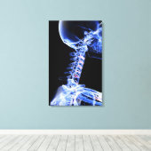 Toile Image par rayons X des os du cou (Insitu (Plancher de Bois))