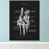 Toile Joints genou Anatomie Art (Insitu (Plancher de Bois))