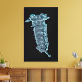Toile La vertèbre cervicale (Insitu(Salon))