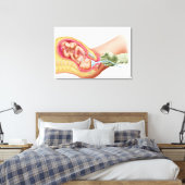 Toile Livraison Du Foetus À L'Aide De L'Extraction Vacue (Insitu(Chambre))