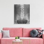 Toile numérique à rayons X enrobée (Insitu(Salon))