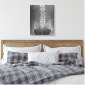 Toile numérique à rayons X enrobée (Insitu(Chambre))