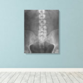 Toile numérique à rayons X enrobée (Insitu (Plancher de Bois))