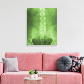 Toile numérique à rayons X enrobée (Insitu(Salon))