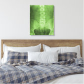 Toile numérique à rayons X enrobée (Insitu(Chambre))
