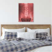 Toile numérique à rayons X enrobée (Insitu(Chambre))