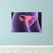 Toile Organe de reproduction féminin, vue par rayons X 2 (Insitu (Plancher de Bois))